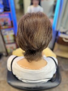 60代からのトリートメント矯正